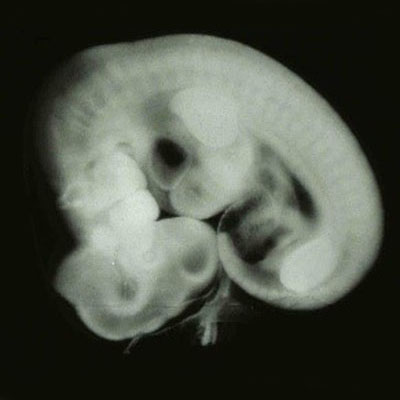 Embryo