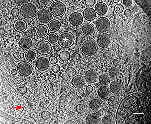 A slice through a cryo-electron tomograms of a membrane patch isolated from PC12 neuroendocrine cells