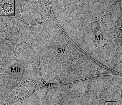 CEMOVIS of an organotypic slice of rat brain