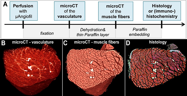 Correlative imaging approach to visualize vasculature and fiber arrangement by microCT and histology