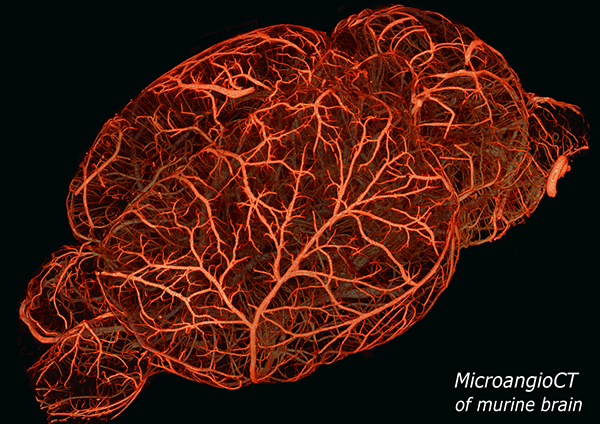 MicroangioCT of murine brain