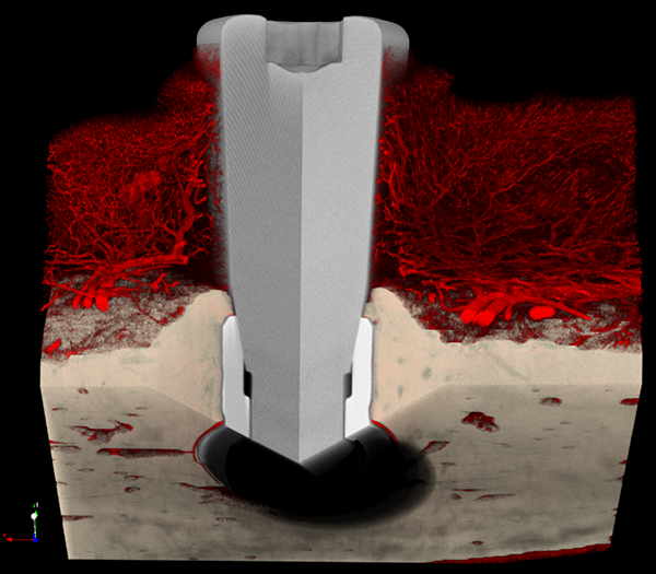 MicroangioCT of the periimplant tissues in the minipig mandibular