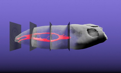 Three-dimensional visualization of tooth sample and its root canal configuration