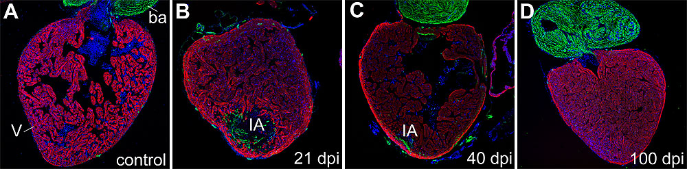 Rückbildung des fibrotischen Gewebes und Herzregeneration nach einer  Kryolesion am Zebrafischherz